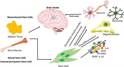 Application of Stem Cells in Stroke: A Multifactorial Approach